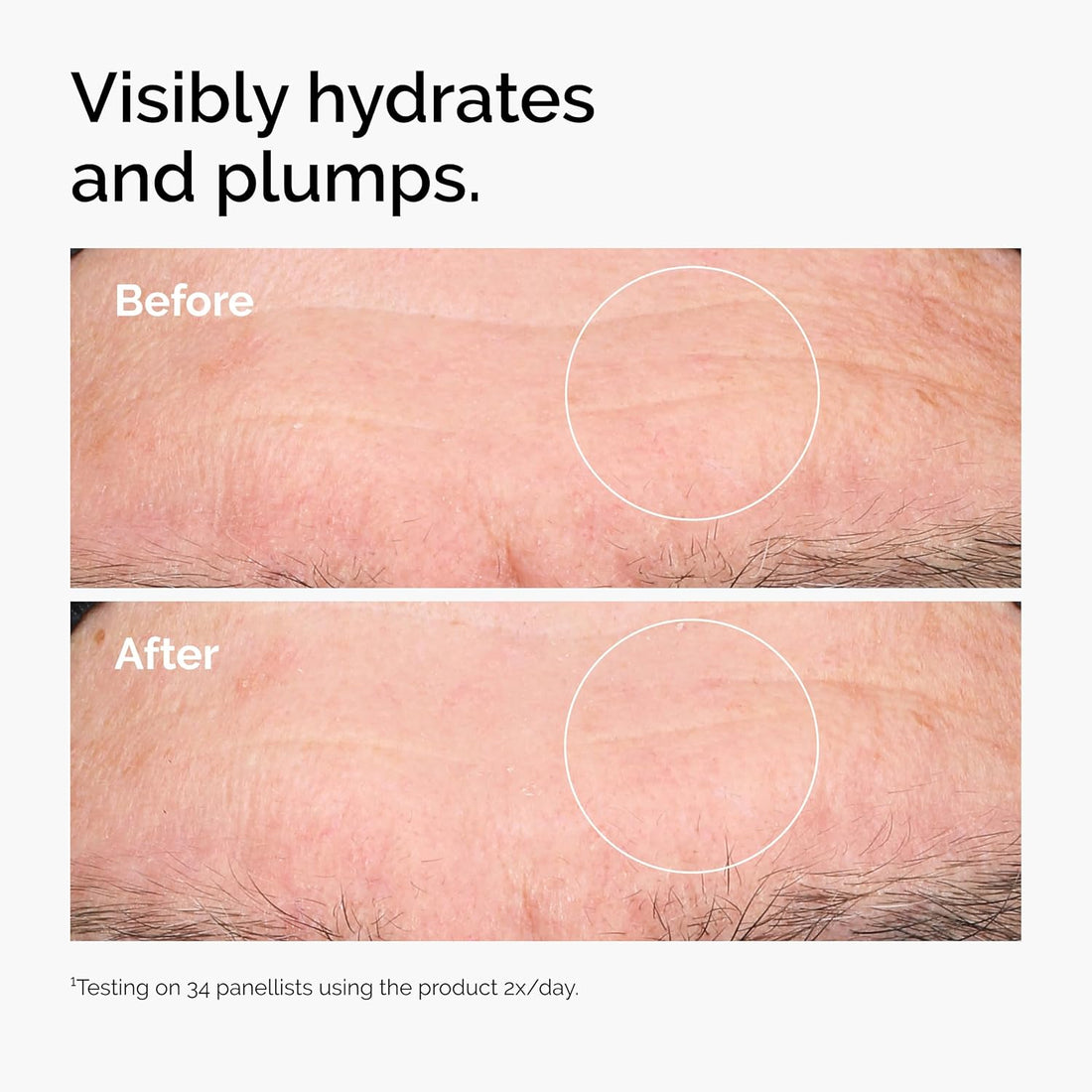 Hyaluronic Acid 2% + B5 (With Ceramides), Multi-Depth Hydration Serum for Plumper, Smoother Skin